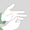 Evalueer of 'n vinger gebreek is