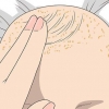 Berg genees