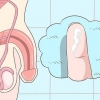Herkenning van die simptome van chlamydia (vir mans)