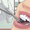Behandeling van 'n dik lip