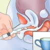 Behandeling van 'n droë vagina