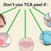 Die toepassing van 'n tca-skil