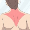 Herwinning van 'n trapezius-stam