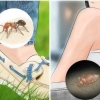 Insectenbeten herkennen