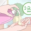 Behandeling van keratosis pilaris