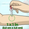 Liggaamshare bleiking