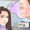Gebruik retinol