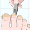 Behandeling van swamnaels