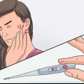 Behandeling van alveolitis