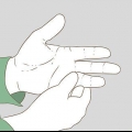 Evalueer of 'n vinger gebreek is