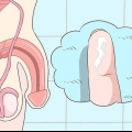 Herkenning van die simptome van chlamydia (vir mans)