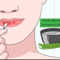 Genees sonverbrande lippe