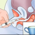Behandeling van 'n droë vagina