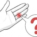 Behandeling van 'n gekneusde vinger