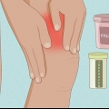 Behandeling van tendonitis in die quadriceps