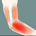 Genees 'n seer arm