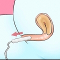 Verwyder 'n tampon