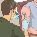 Verwyder 'n tatoeëermerk