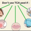 Die toepassing van 'n tca-skil