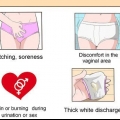 Behandeling van 'n vaginale gisinfeksie