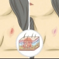 Gee 'n hickey
