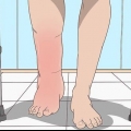 Behandeling van swelling