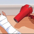 Jy krap as jy onder jou gips jeuk
