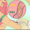 Bereken jou totale cholesterol