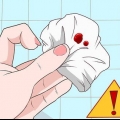 Stop rektale bloeding