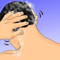 Gebruik rogaine of minoxidil