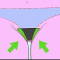Verwyder skaamhare rondom die vagina