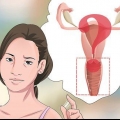 Diagnose van vaginale afskeiding