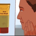 Raak ontslae van 'n puisie met aloe vera gel