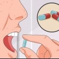 Behandeling van waterpokkies
