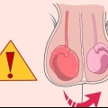 Weet of jy epididimitis het