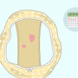 Herkenning van abnormale bloeding tussen menstruasieperiodes
