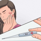 Behandeling van alveolitis