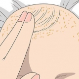 Berg genees