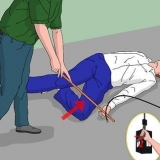 Behandeling van elektriese brandwonde
