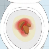 Herkenning van die simptome van kolonkanker