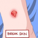 Herken die simptome van 'n mrsa-infeksie