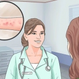 Verligting van die simptome van spongiotiese dermatitis