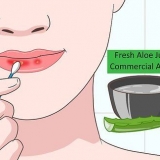 Genees sonverbrande lippe