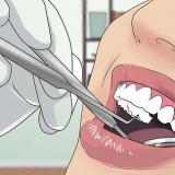 Behandeling van 'n dik lip