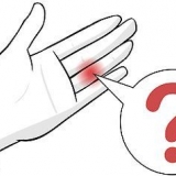 Behandeling van 'n gekneusde vinger