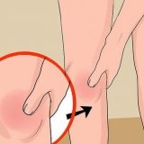 Behandeling van 'n geswelde knie