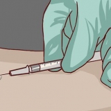 Lees 'n veltoets vir tuberkulose