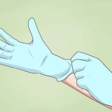 Steriliseer 'n naald
