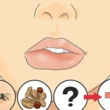 Genees 'n geswelde lip
