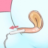 Verwyder 'n tampon